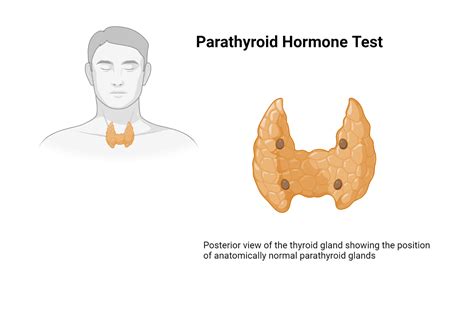 A Comprehensive Guide to Understanding and Managing Parathyroid Hormone (PTH) Level: parathd-3723