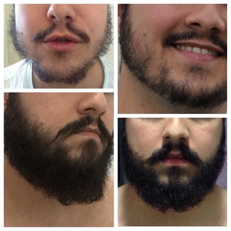 A Jornada do Barba Perfeita: Desvendando o Poder do Minoxidil para uma Barba Farta