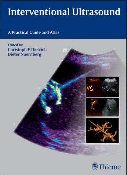 A Practical Guide to 3D Ultrasound, 1E (2015) [PDF][UnitedVRG] Kindle Editon