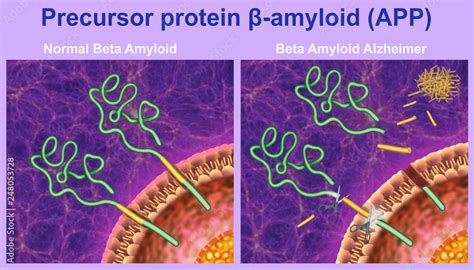 A Proteína Beta-Amilóide e o Alzheimer: Um Guia Essencial