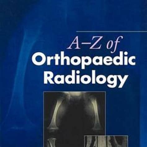 A-Z of Orthopaedic Radiology Kindle Editon