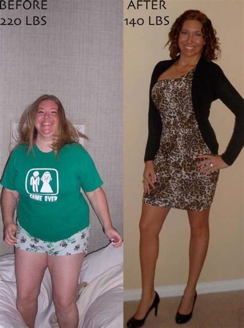 ACV Before and After Weight Loss: Lose 15 Lbs in 30 Days