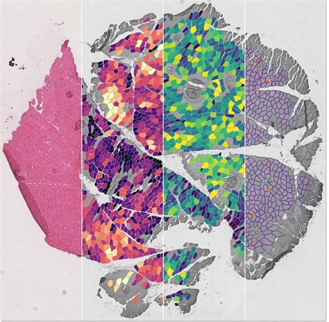 AI-Assisted Image Analysis: