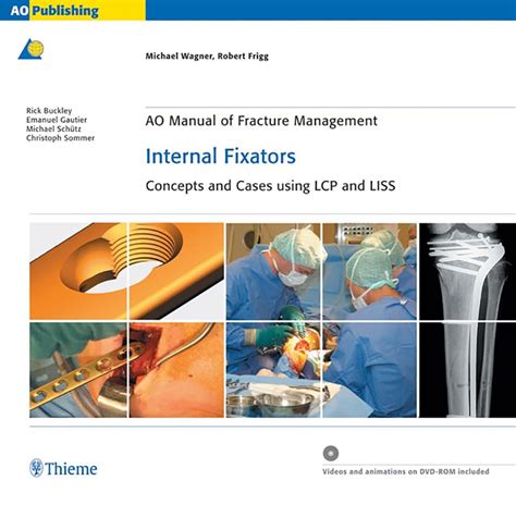 AO Manual of Fracture Management - Internal Fixators Concepts and Cases Using LCP/LISS Epub