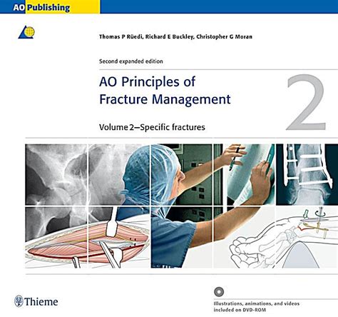 AO Principles of Fracture Management 2 Vols. 2nd Edition Kindle Editon