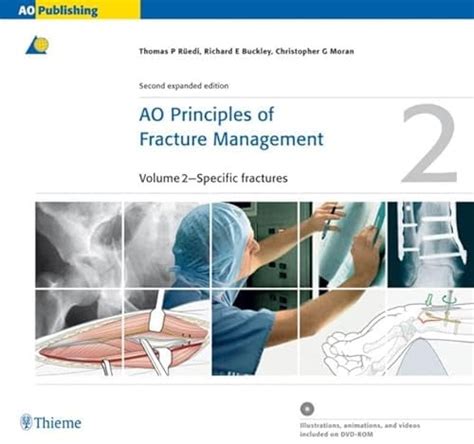 AO Principles of Fracture Management 2 Vols. 2nd Edition Kindle Editon