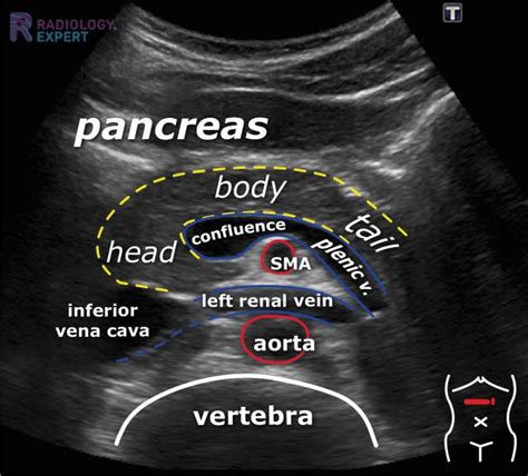 Abdominal Sonography Doc