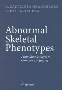 Abnormal Skeletal Phenotypes From Simple Signs to Complex Diagnoses 1st Edition PDF