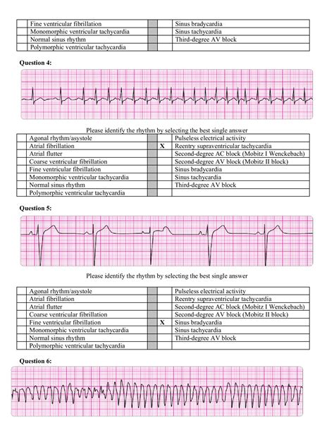 Acls Test Answers 2013 Doc