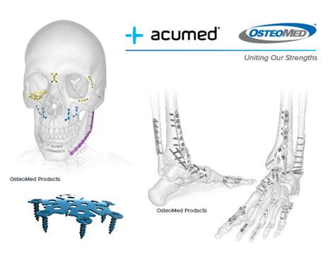 Acumed Medical: A Legacy of Innovation and Excellence