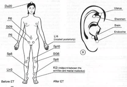 Acupuncture Fertility Points Chart