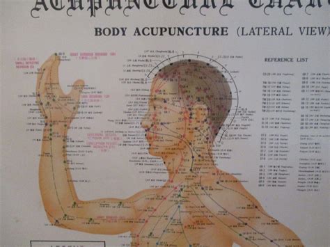 Acupuncture Wall Charts Kindle Editon