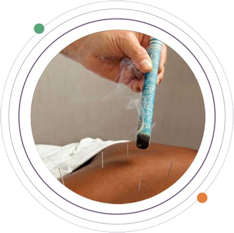 Acupuncture and Moxibustion:
