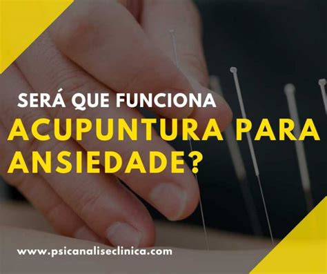 Acupuntura para Ansiedade: Um Guia Essencial para Calma e Bem-Estar