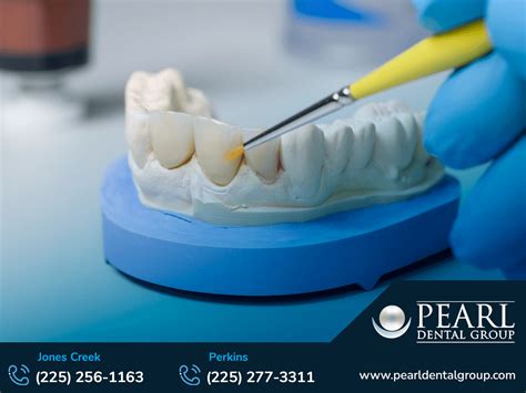 Admiral Dental Care: Redefining Oral Health with Unparalleled Expertise and Patient-Centered Care