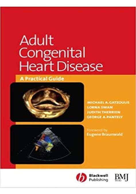 Adult Congenital Heart Disease A Practical Guide Kindle Editon