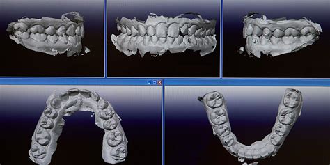 Advanced Dental Technologies Revolutionizing Oral Health in Boon Keng