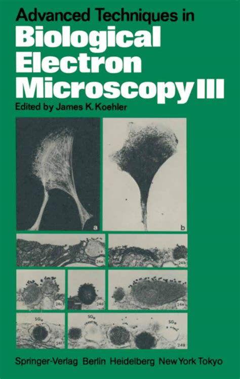 Advanced Techniques in Biological Electron Microscopy III Kindle Editon