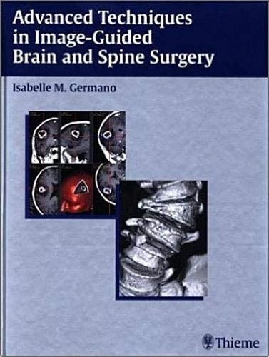 Advanced Techniques in Image-Guided Brain and Spine Surgery 1st Edition Doc
