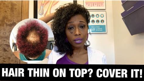 African American Hair Topper for Thinning Crown: A Comprehensive Guide