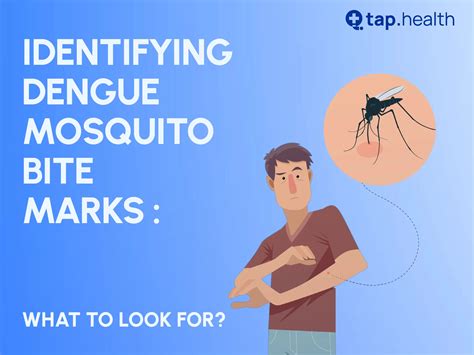 After Bite Dengue Mosquito: A Comprehensive Guide 2025