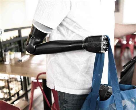 Aguilar's Revolutionary Prosthetics