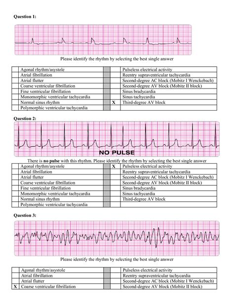 Aha Acls Pretest 2011 Answers Kindle Editon