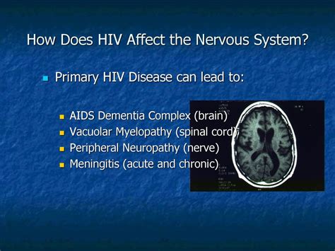 Aids and the Nervous System PDF