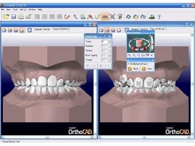 Align Technology Inc. - A Leading Force in Orthodontics