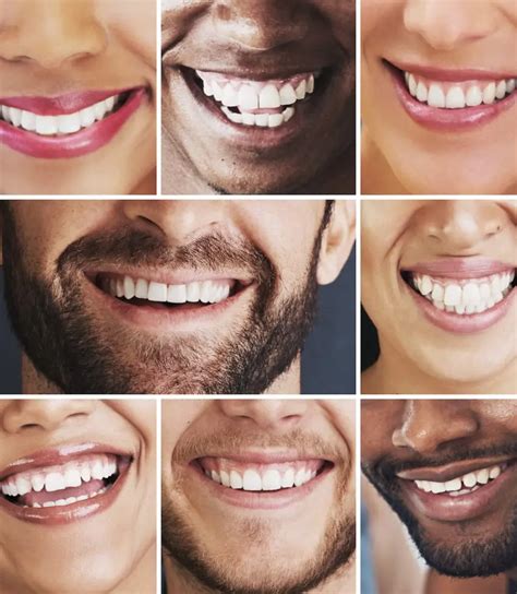 Alismilesforyou: Your Guide to Achieving a Brighter, Healthier Smile