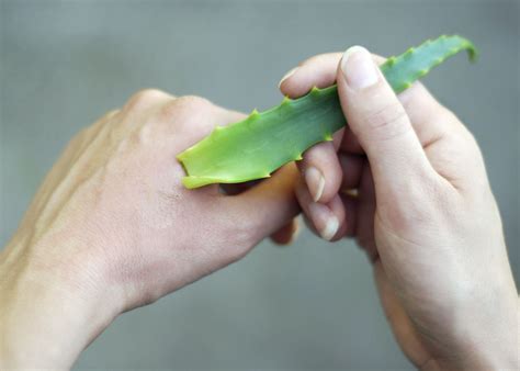 Aloe Vera: Nature's Remedy for Burns