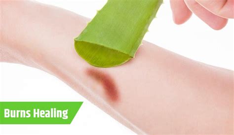 Aloe for That Burn: A Comprehensive Guide to Soothing and Healing Burns