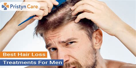 Alopecia The Complete Guide On Treatments and Remedies Stop Hair Loss In Men Epub