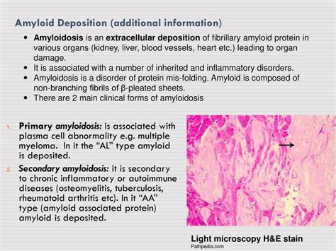 Amyloidosis: Unraveling the Mysterious Protein Deposition Disorder