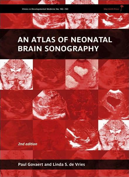 An Atlas of Neonatal Brain Sonography (Hardcover) Ebook Epub