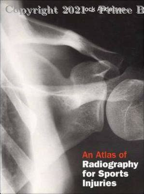 An Atlas of Radiography for Sports Injuries Reader
