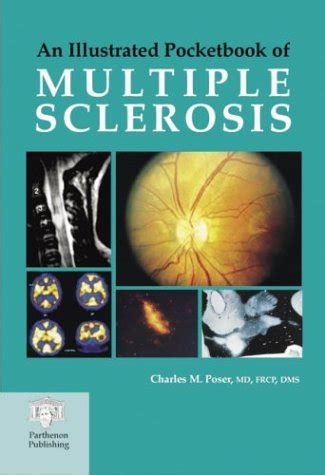 An Illustrated Pocketbook of Multiple Sclerosis 1st Edition PDF