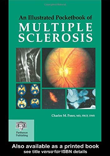 An Illustrated Pocketbook of Multiple Sclerosis 1st Edition Doc