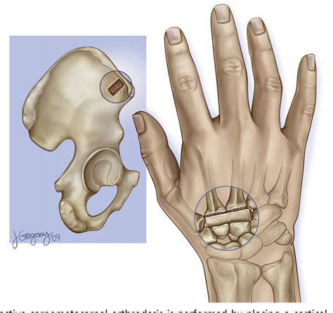 Anatomy of the Knuckle Bone