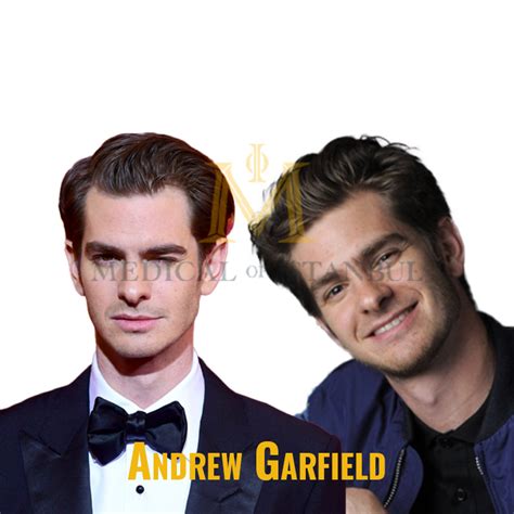 Andrew Garfield: A Journey Through Transformation and Triumph