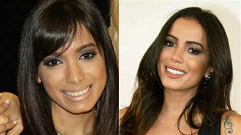 Anitta Before and After: A Visual Journey Through Her Transformation