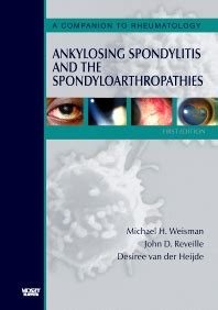 Ankylosing Spondylitis and the Spondyloarthropathies A Companion to Rheumatology 1st Edition Doc