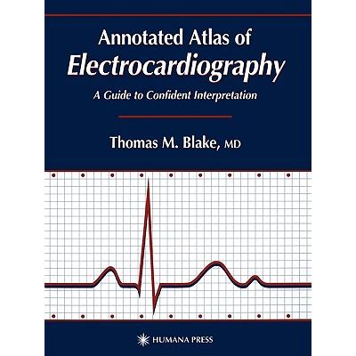 Annotated Atlas of Electrocardiography A Guide to Confident Interpretation 1st Edition Reader