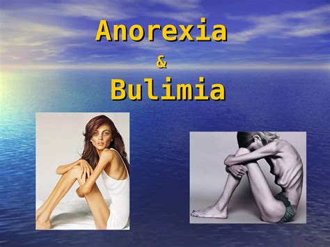 Anorexia and Bulimia (Diseases and Disorders) PDF