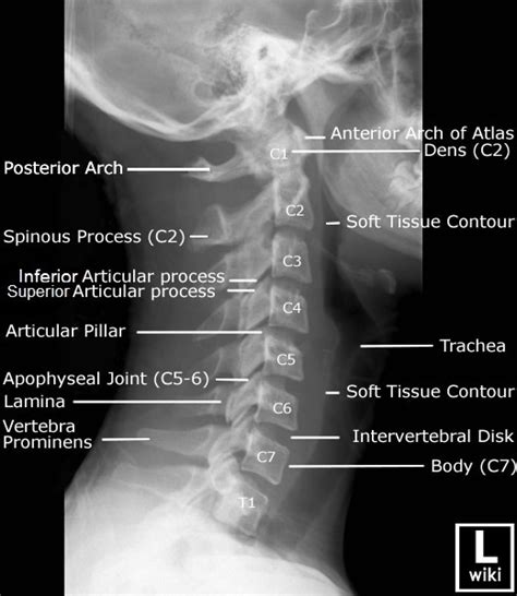 Anterior Part of Neck Radiographic Anatomy Positioning And Procedures Doc