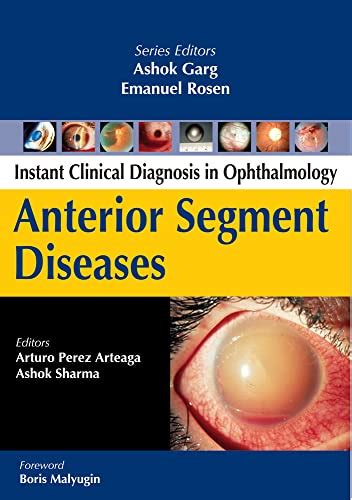 Anterior Segment Diseases Instant Clinical Diagnosis in Ophthalmology Doc