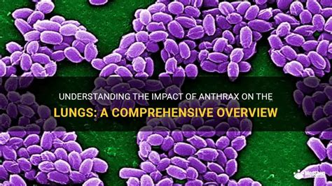 Anthrax: A Comprehensive Overview