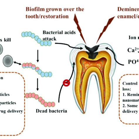 Anti-caries composites: