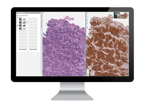 Aperio Definiens Digital Pathology Solutions Kindle Editon