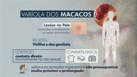 Aposta na varíola: Compreendendo os riscos e benefícios